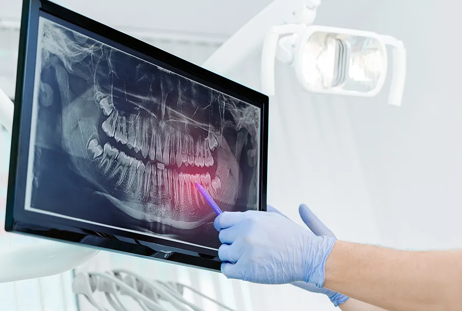 Revolutionizing Dental Care with Digital X-Rays in Salt Lake City, UT