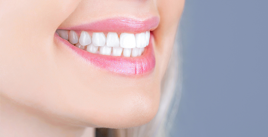 The Ultimate Guide to Teeth Whitening in Salt Lake City, UT: Achieve a Brighter Smile